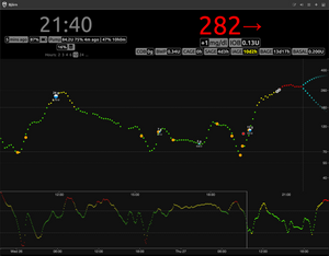 NightScout docker DT1 1/2